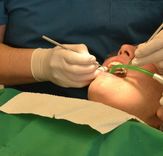 (Info) Ab 2025: Amalgam-Verbot beim Zahnarzt - Was bedeutet dies für Kassenpatienten?